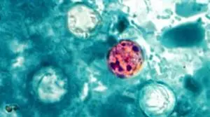 Kentucky among states in Cyclospora outbreak linked to Taco Bell lettuce