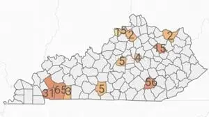 Measles reaches 200 cases in Kentucky